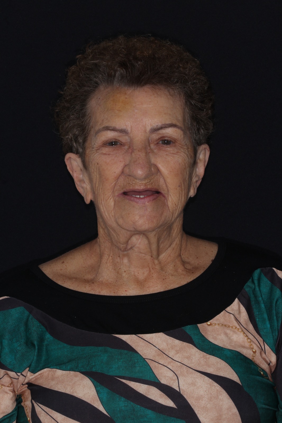 Caso 1 — antes do tratamento